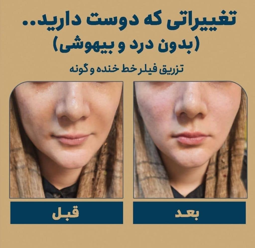 مرکز زیبایی و لیزر موهای زائد لیدا لیزر در بابل