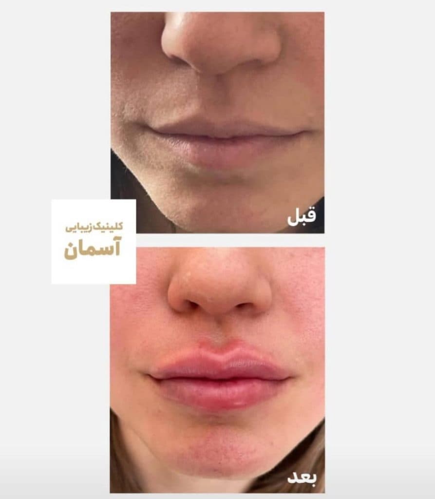 مرکز زیبایی و لیزر موهای زائد لیدا لیزر در بابل