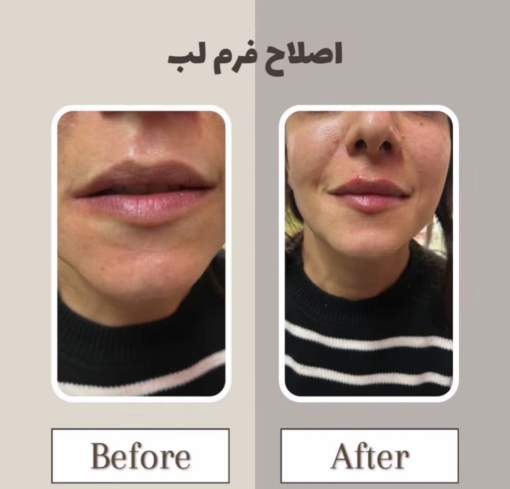 کلینیک زیبایی پوست و مو دکتر فاطمه افشاری در عظیمیه کرج