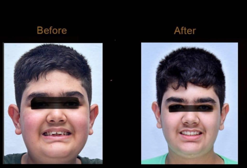 مطب ارتودنسی دکتر شادکام در یزد