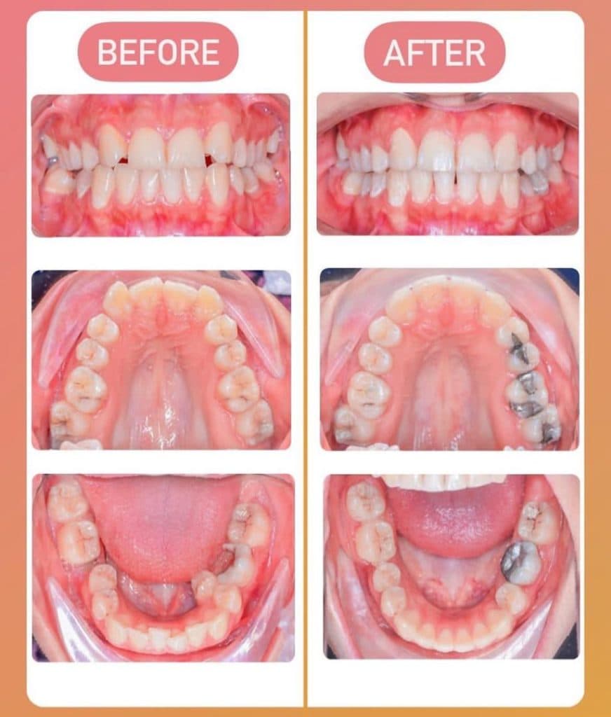 مطب ارتودنسی دکتر شادکام در یزد