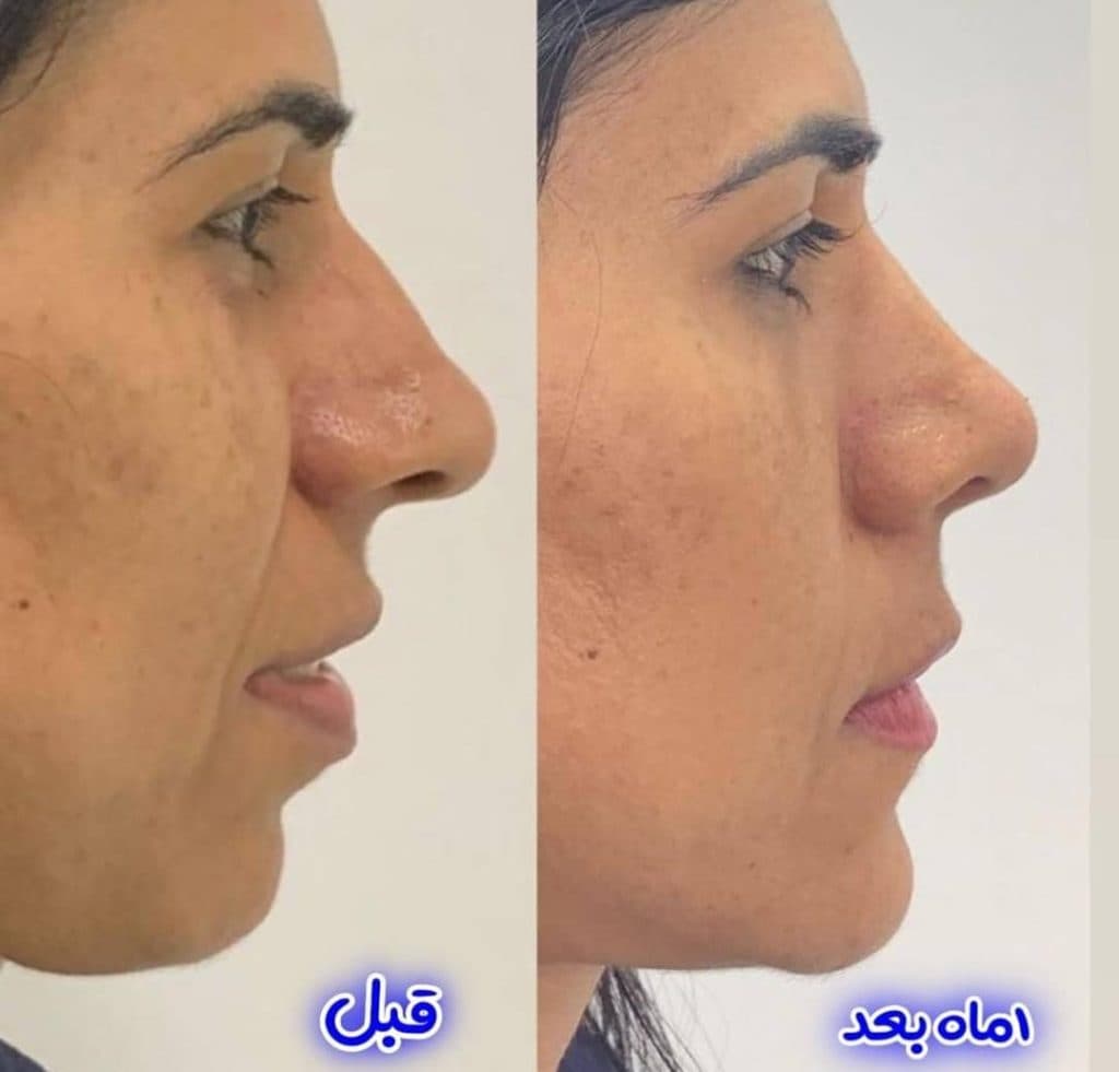 مطب زیبایی ماریسا در پاسداران شیراز