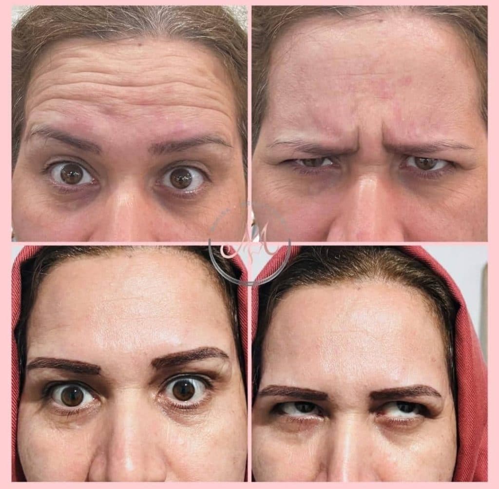 مطب زیبایی ماریسا در پاسداران شیراز