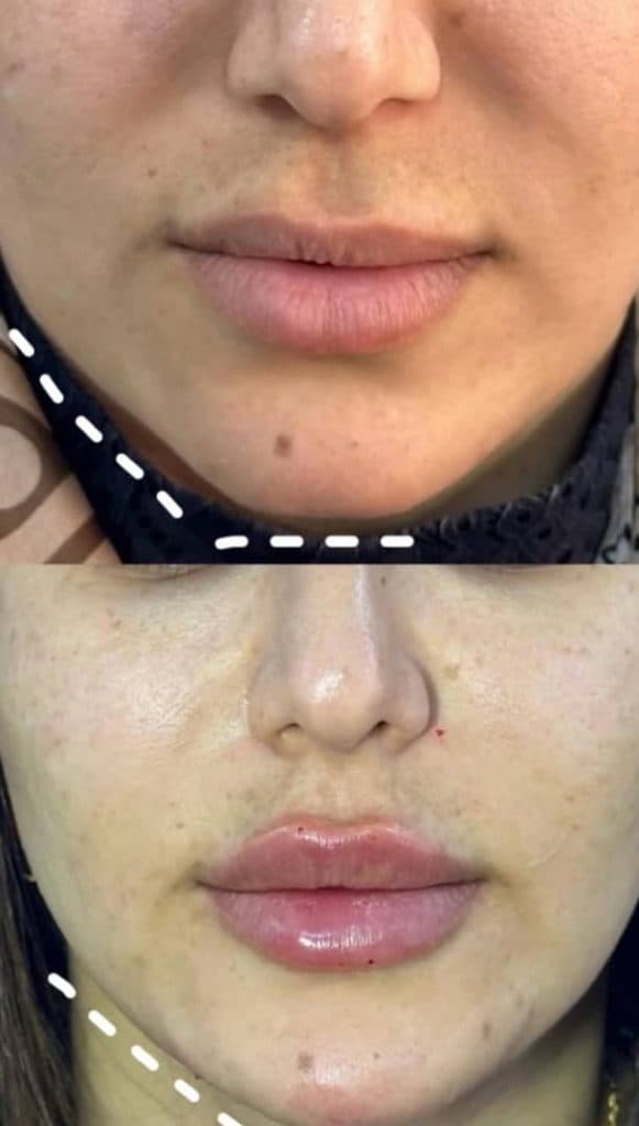 مطب زیبایی ماریسا در پاسداران شیراز