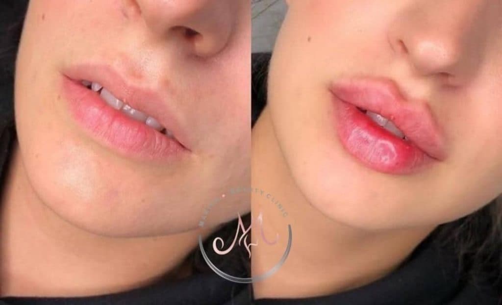 مطب زیبایی ماریسا در پاسداران شیراز