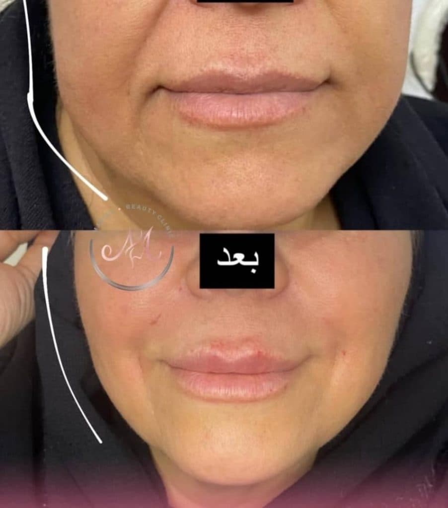 مطب زیبایی ماریسا در پاسداران شیراز