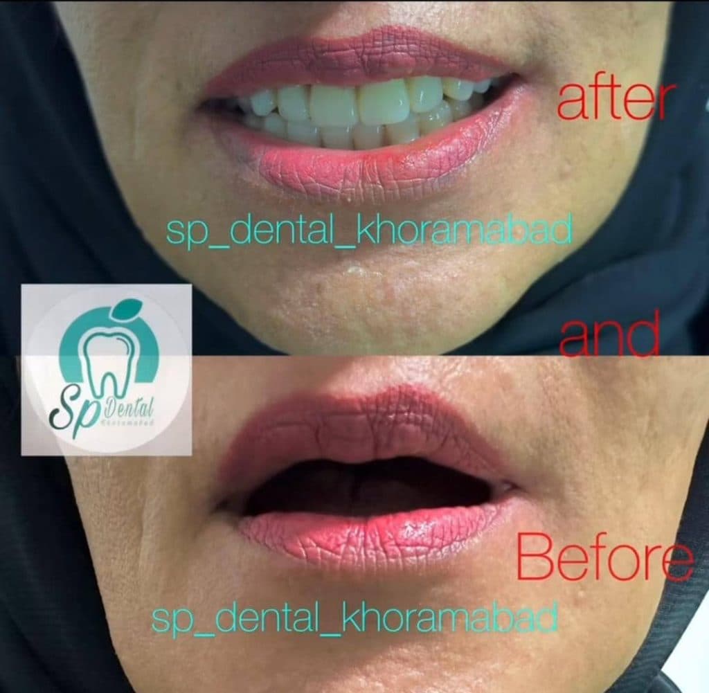 مرکز پروتز متحرک دندان اسپی دنتال در انقلاب خرم آباد