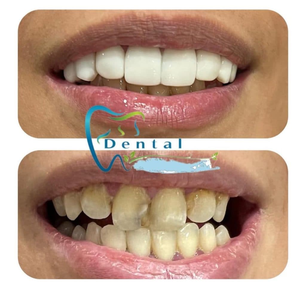 مطب دندانپزشکی آذر در بلوار فردوس تهران