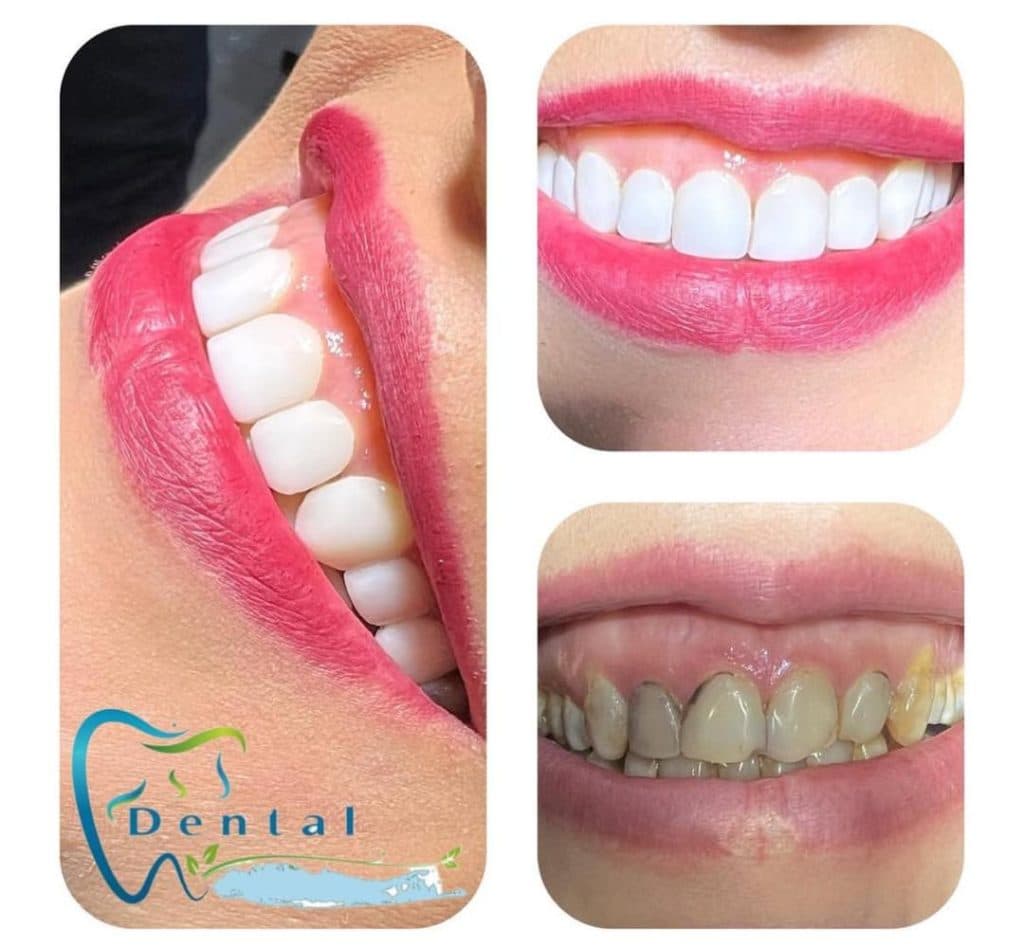 مطب دندانپزشکی آذر در بلوار فردوس تهران