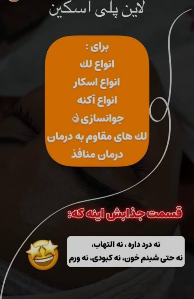 مرکز لیزر با دستگاه کندلا دکتر هامون صفوی در یزد