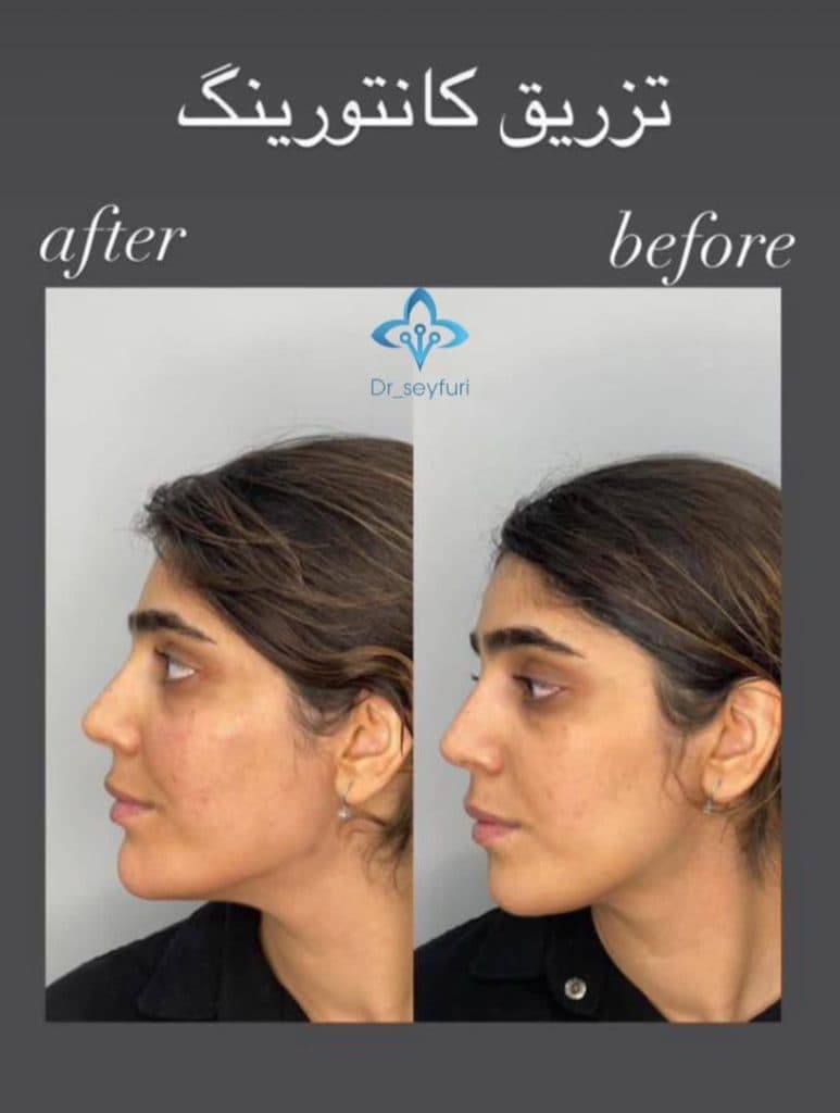 مرکز زیبایی دکتر فهیمه سیفوری در محمدآباد قرچک