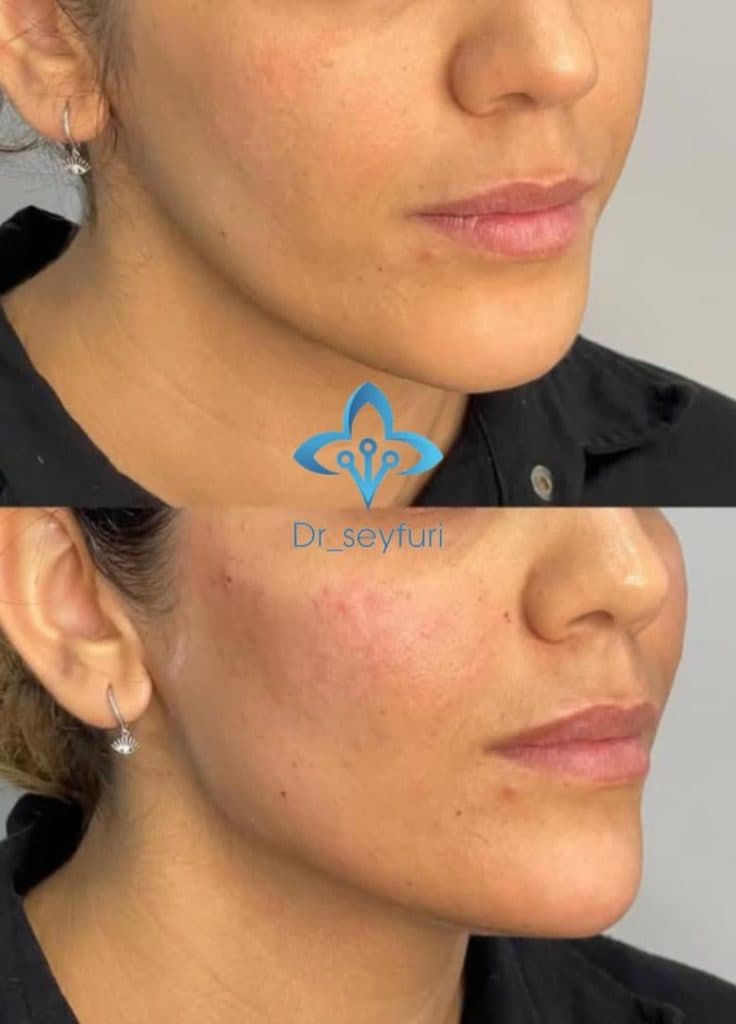 مرکز زیبایی دکتر فهیمه سیفوری در محمدآباد قرچک