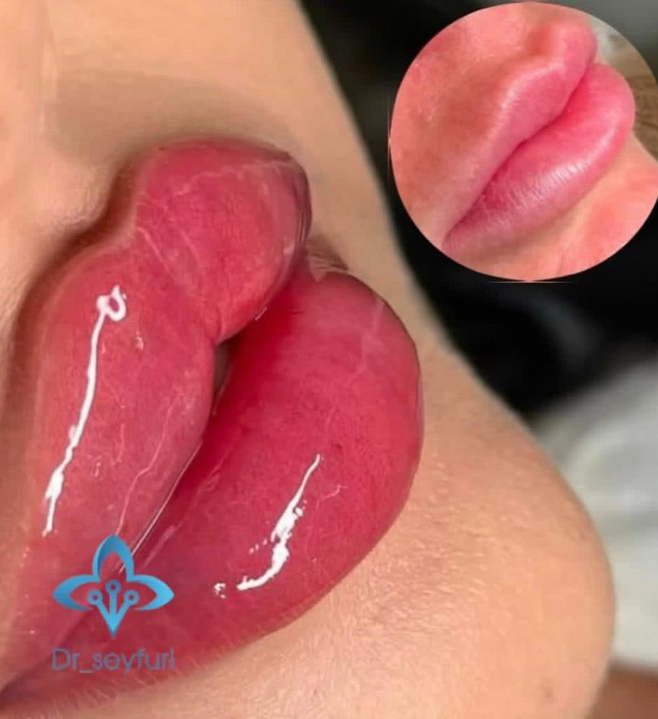 مرکز زیبایی دکتر فهیمه سیفوری در محمدآباد قرچک