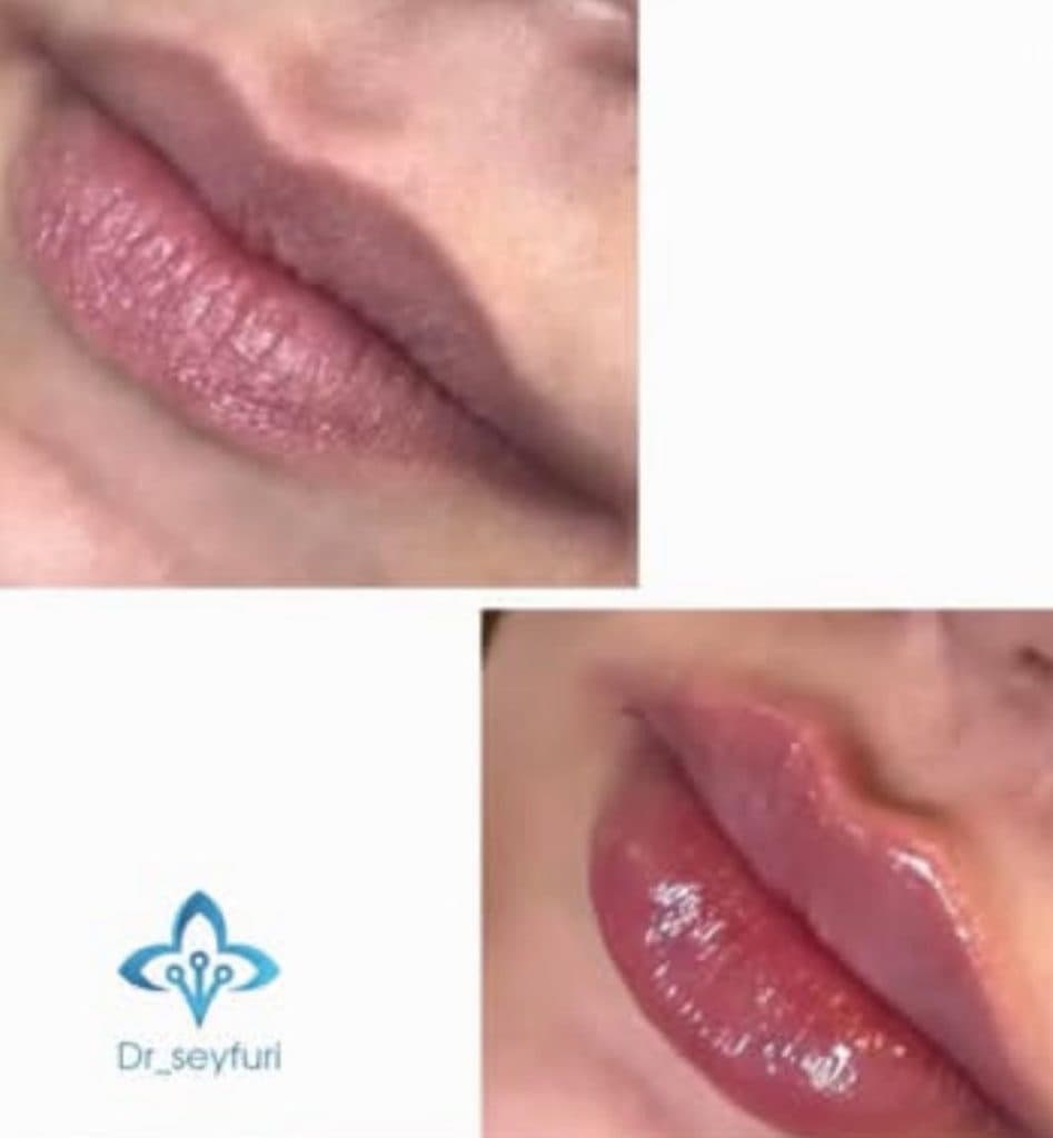 مرکز زیبایی دکتر فهیمه سیفوری در محمدآباد قرچک