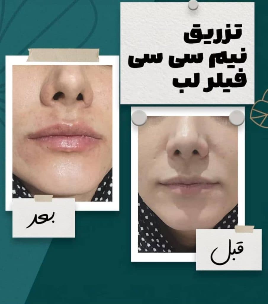 مرکز زیبایی و لاغری لوتوس در نجف آباد