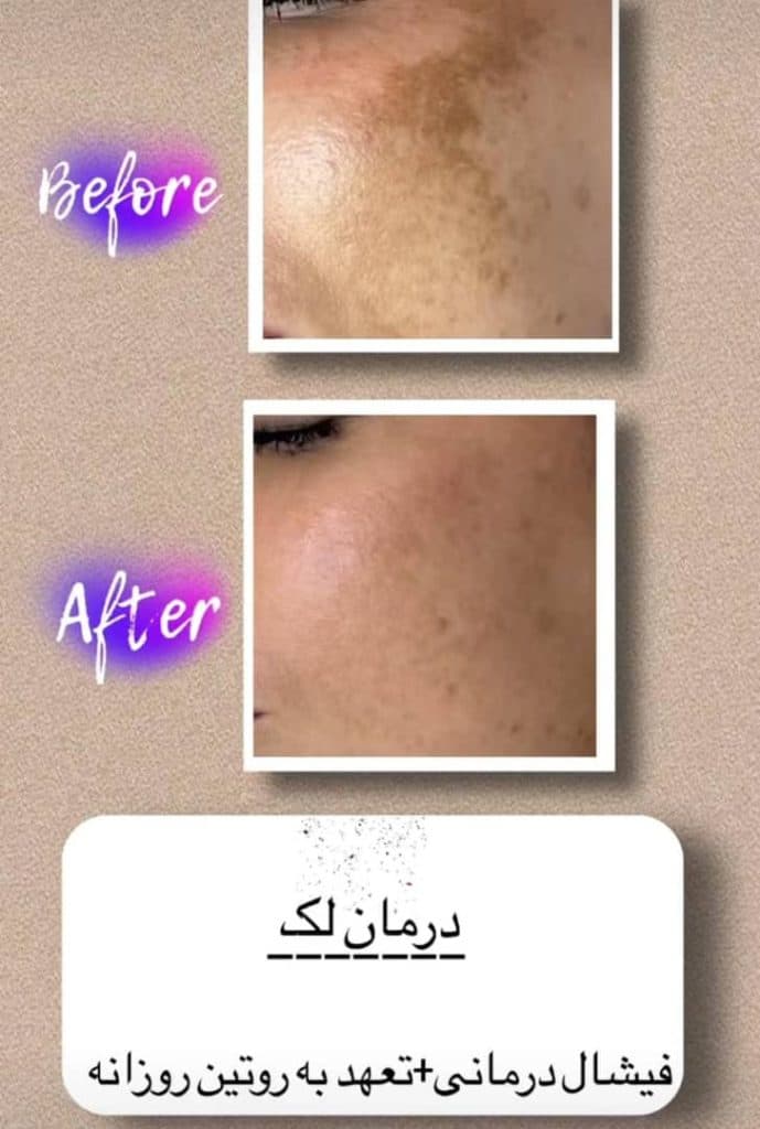 کلینیک زیبایی پوست و مو دلیار در زنجان