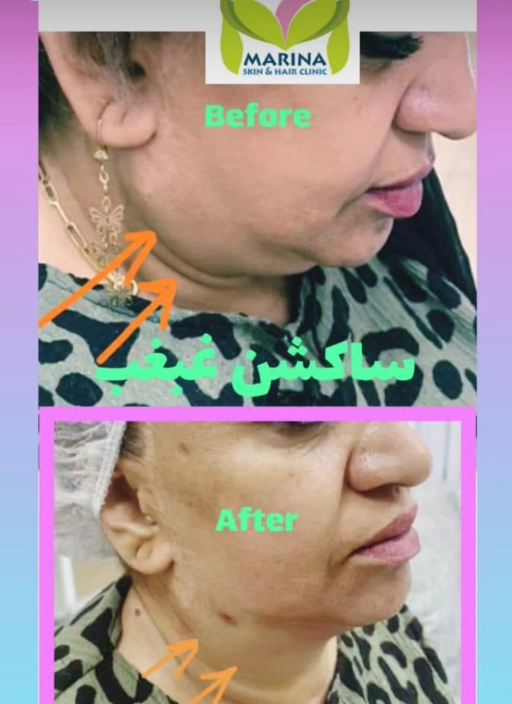 کلینیک زیبایی پوست و مو مارینا در عفیف آباد شیراز