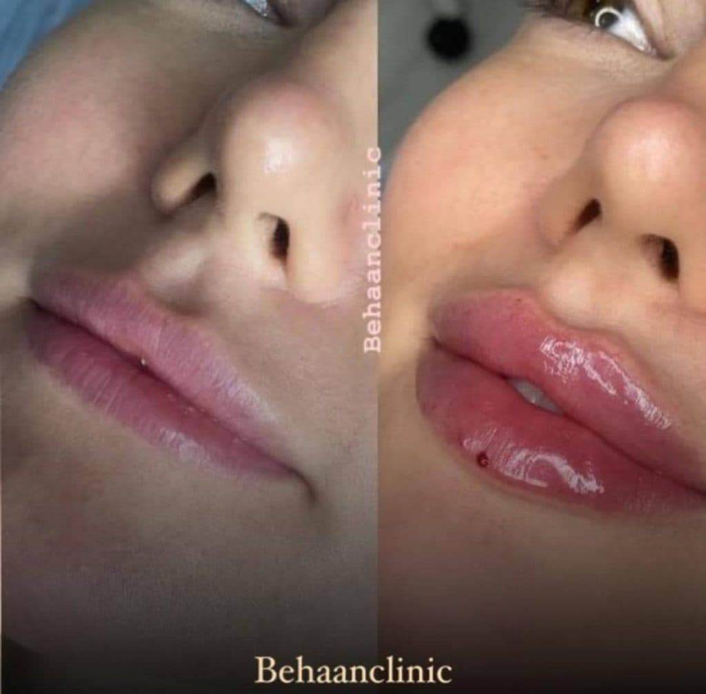 کلینیک تخصصی زیبایی لاغری بهان در آمل