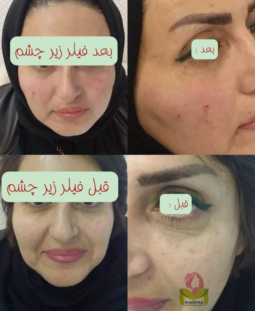 کلینیک زیبایی پوست و مو مارینا در عفیف آباد شیراز