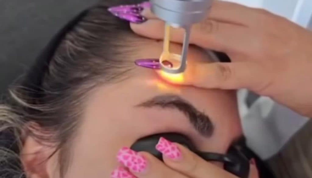 پاک کردن و ریمو تتو با لیزر رامونا لند در تهرانپارس تهران