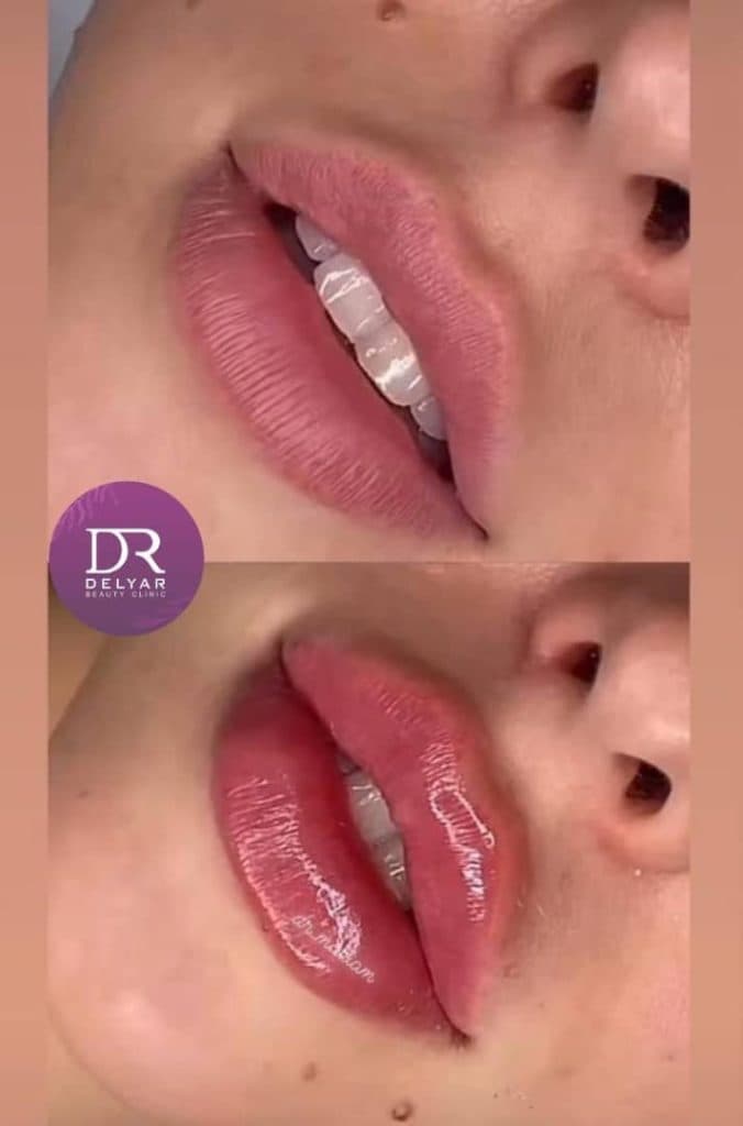 کلینیک زیبایی پوست و مو دلیار در زنجان