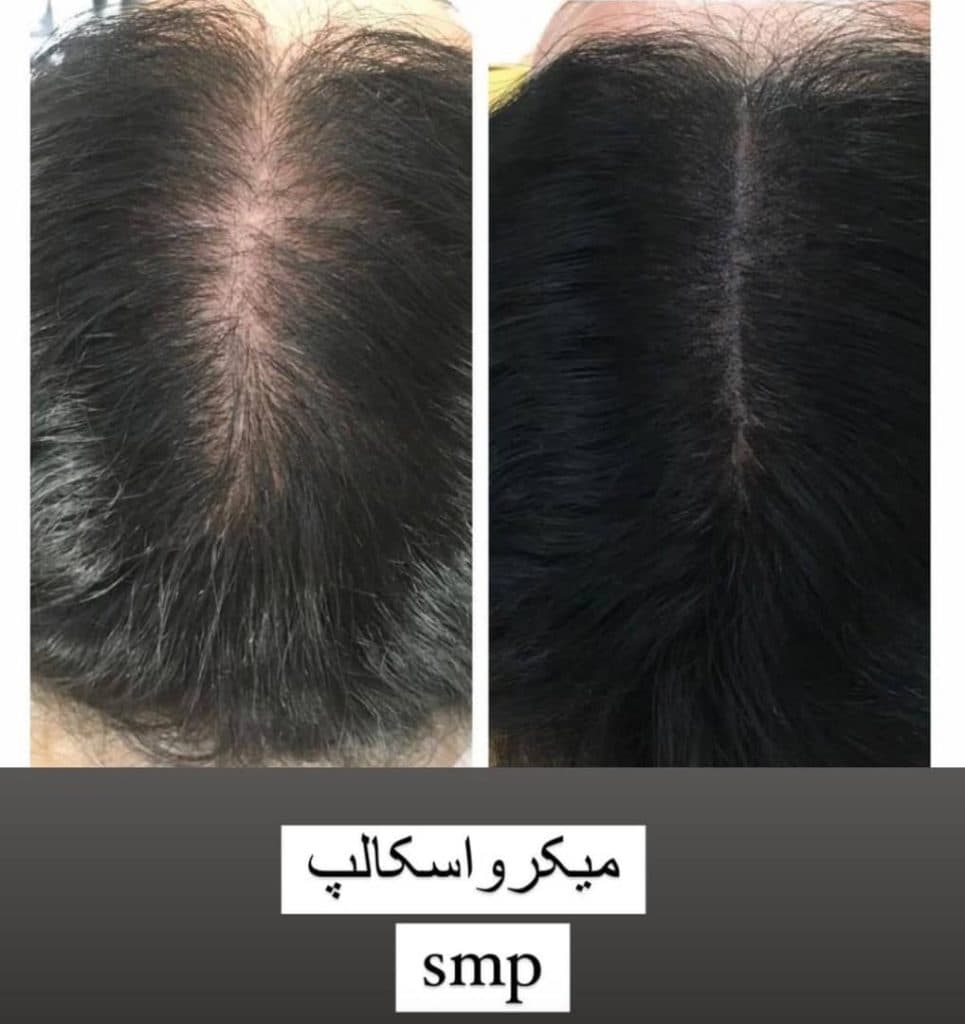 کلینیک زیبایی پوست و مو دلیار در زنجان