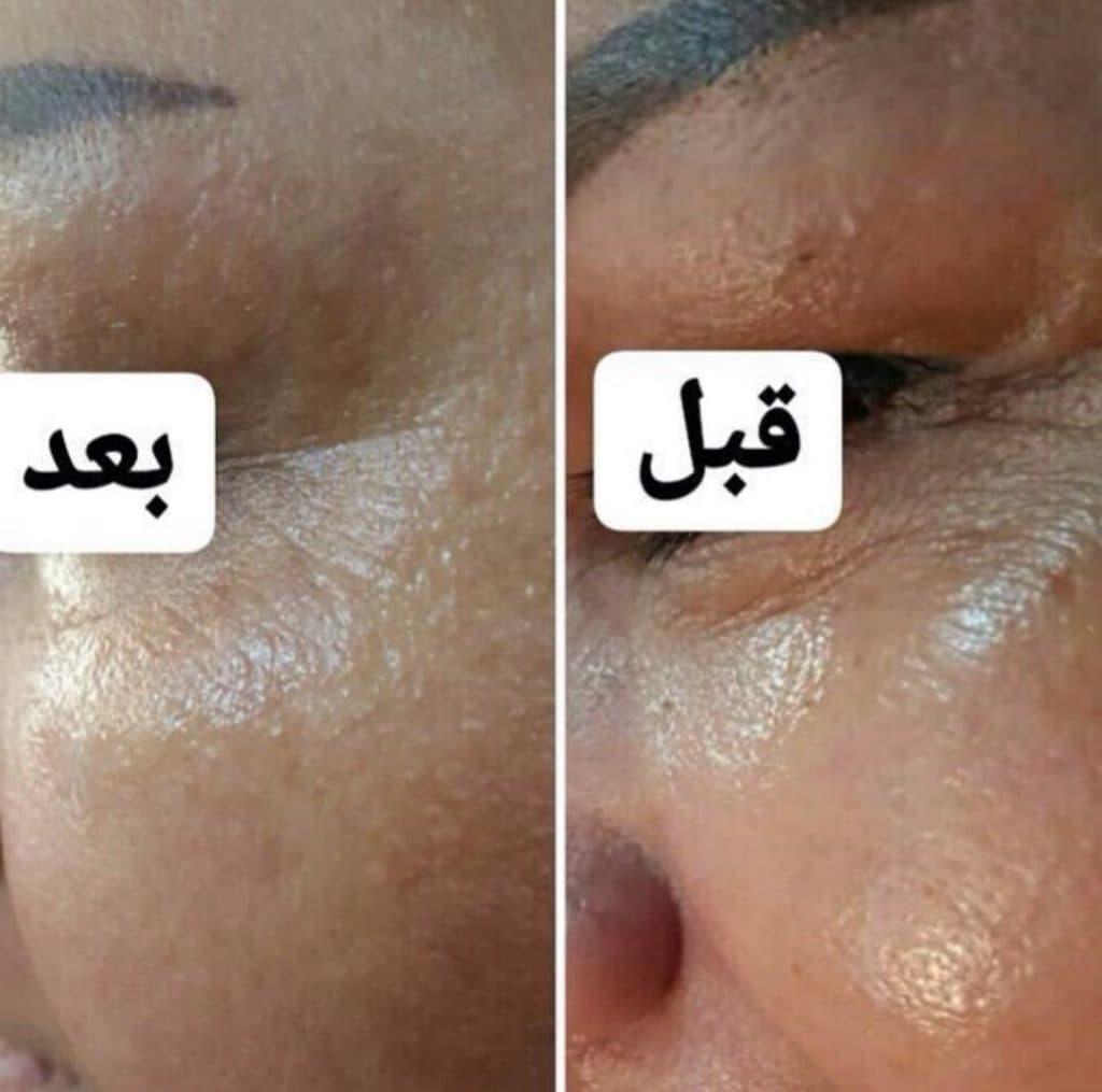 کلینیک زیبایی پروا در ۲۲ بهمن اراک