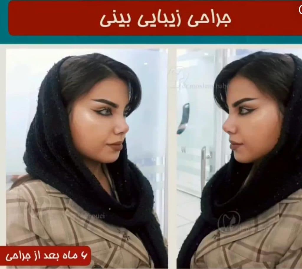 مطب زیبایی دکتر بابویی در منتظری بندر ماهشهر