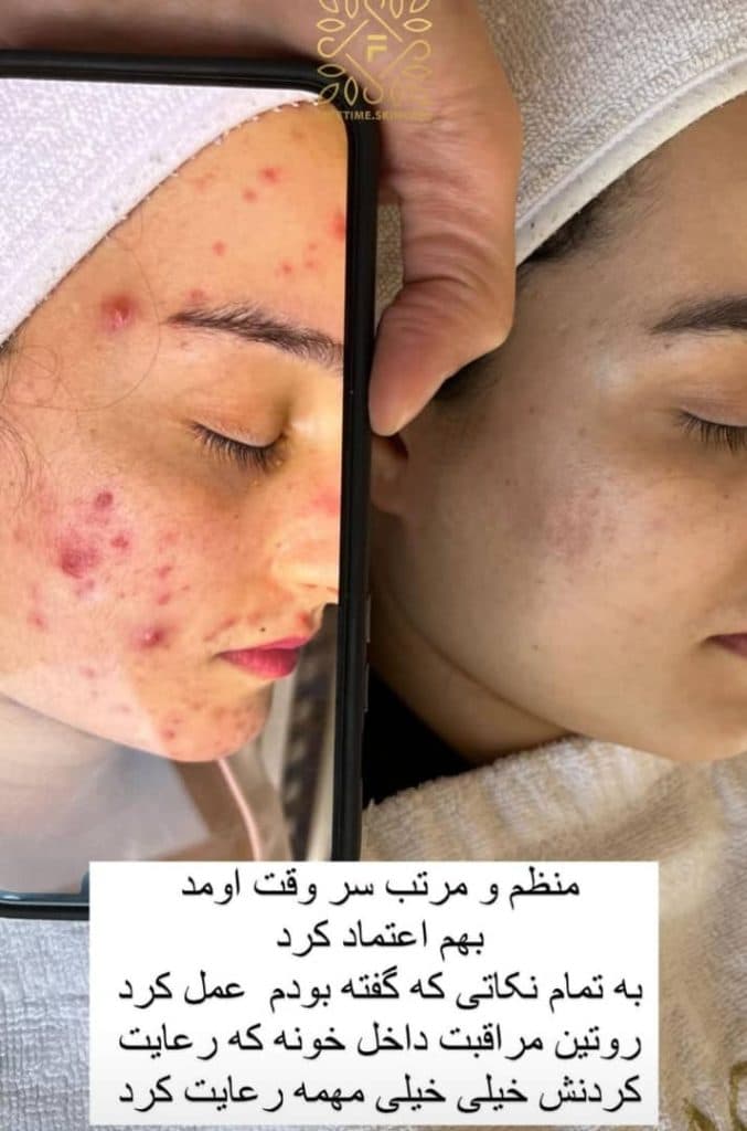 مرکز آموزش خدمات پاکسازی مراقبت از پوست و مو فیس تایم سارا محمدی در اصفهان