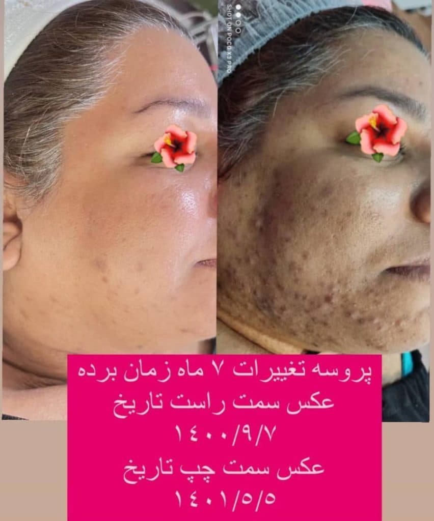 آموزش و خدمات تخصصی پاکسازی مراقبت از پوست و مو مریم ماندگار در بندرعباس