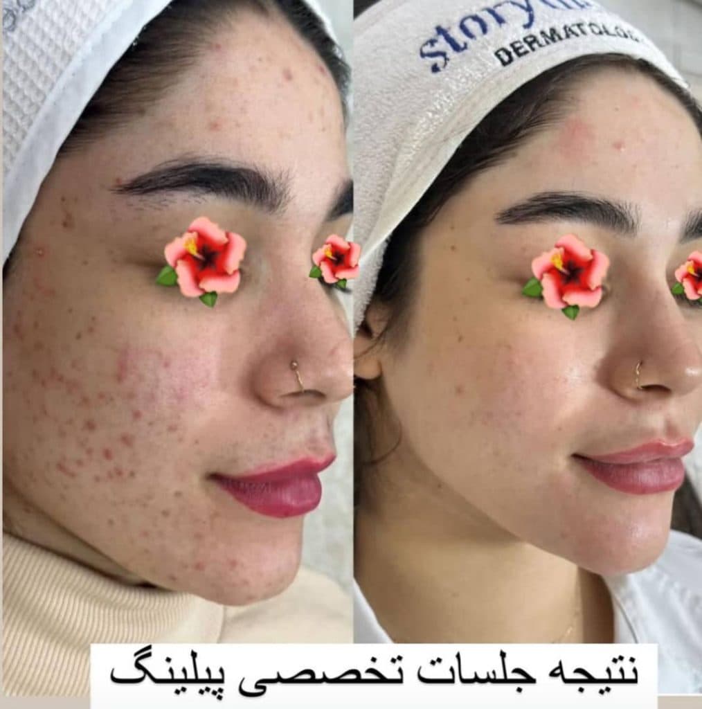 آموزش و خدمات تخصصی پاکسازی مراقبت از پوست و مو مریم ماندگار در بندرعباس