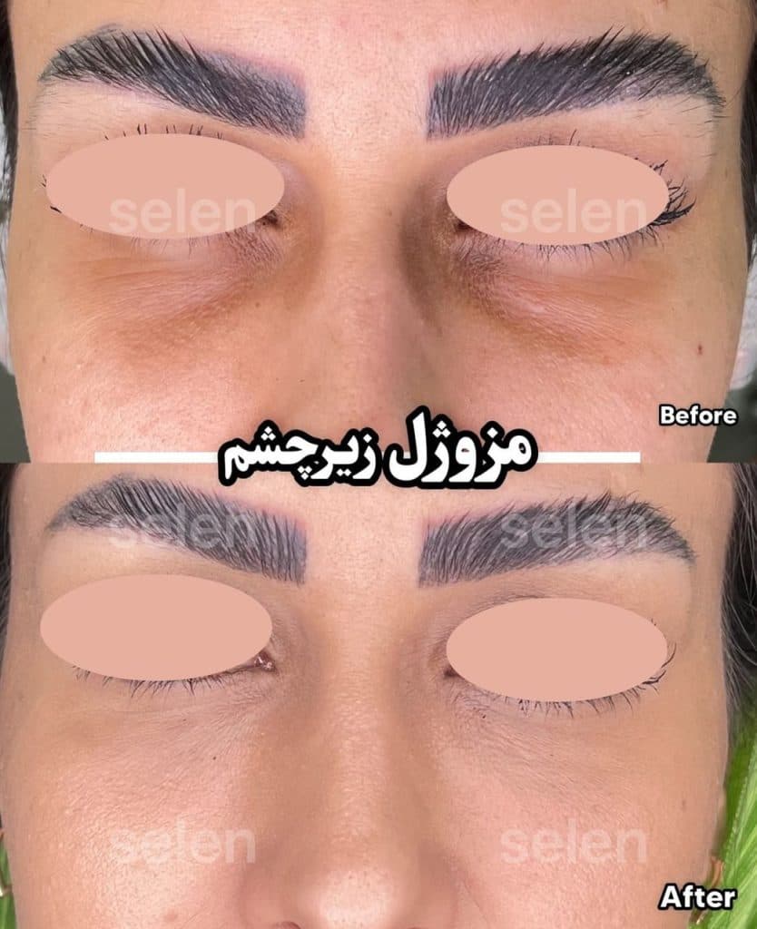 کلینیک تخصصی زیبایی پوست و مو سلن در بلوار سجاد مشهد