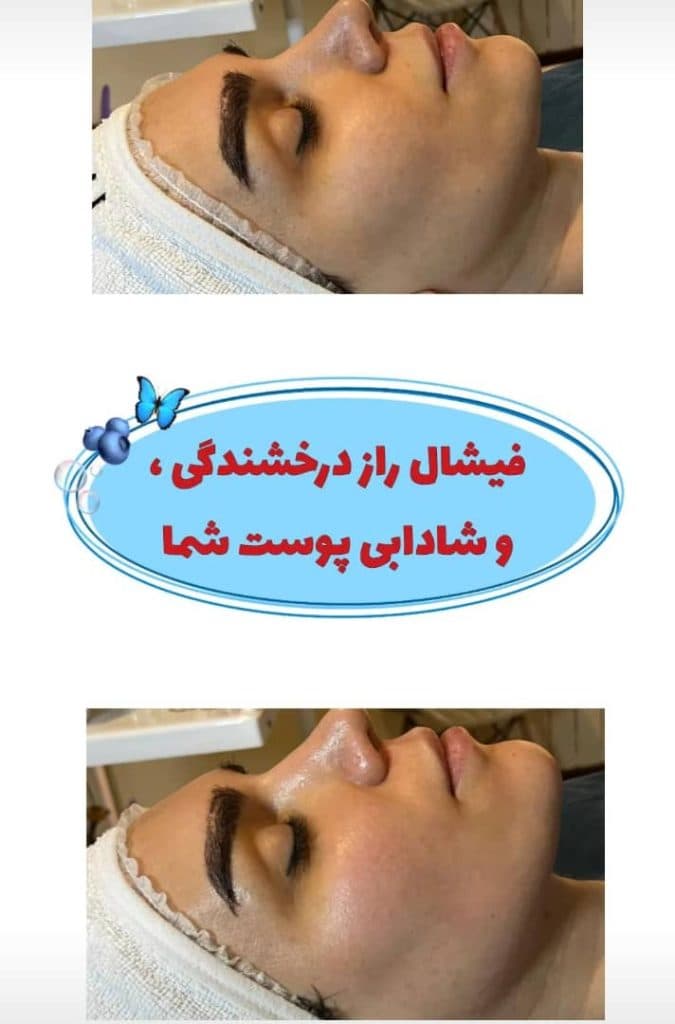 مرکز تخصصی آموزش خدمات پاکسازی مراقبت پوست و مو هیوه در شهرک غرب تهران