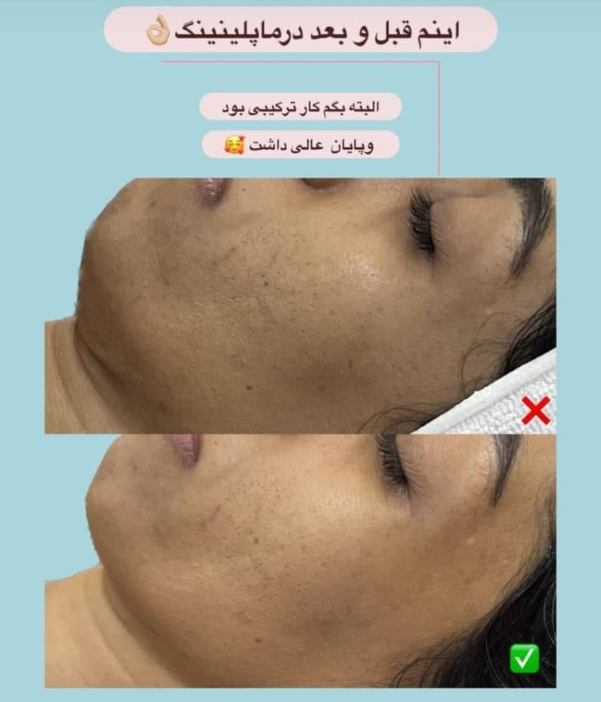 آموزش و خدمات تخصصی پاکسازی مراقبت از پوست و مو مریم ماندگار در بندرعباس