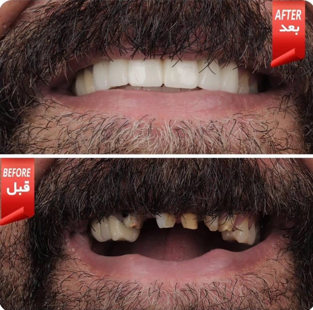 دندانسازی زارعی در یزد