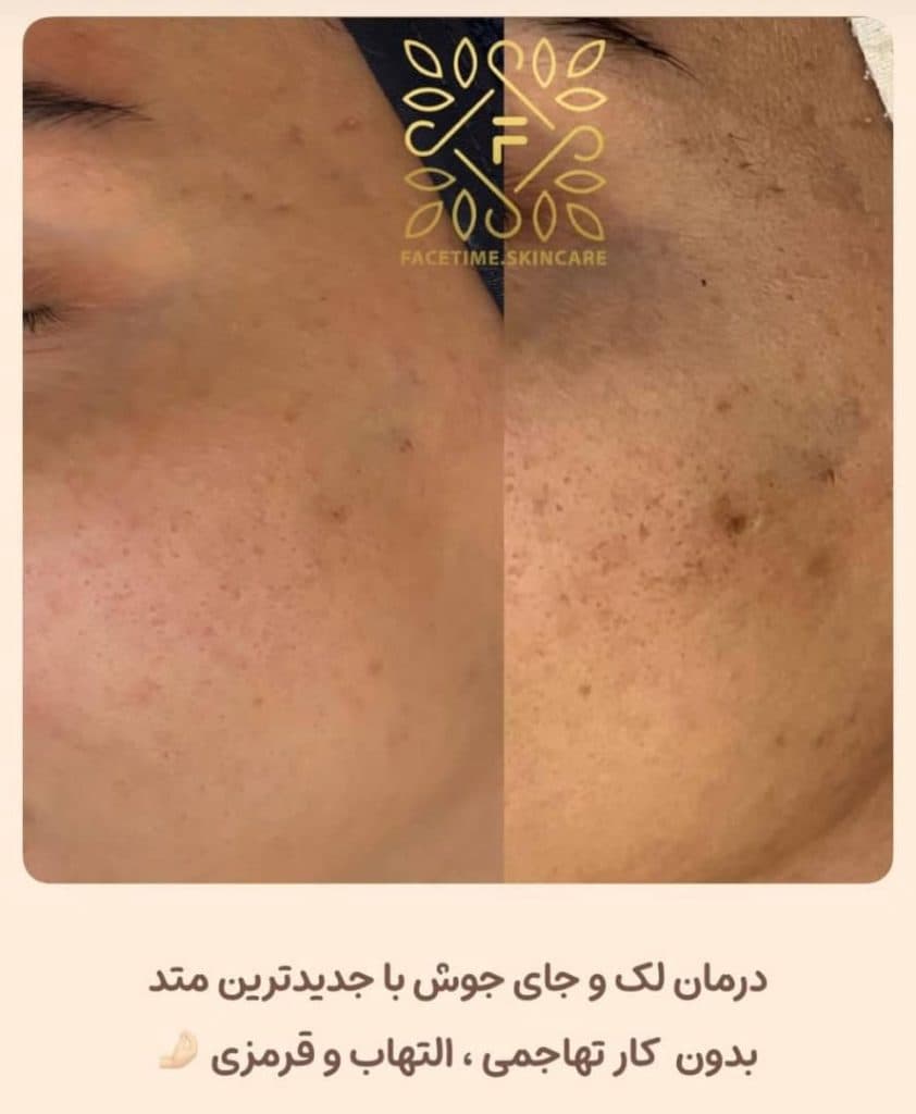 مرکز آموزش خدمات پاکسازی مراقبت از پوست و مو فیس تایم سارا محمدی در اصفهان