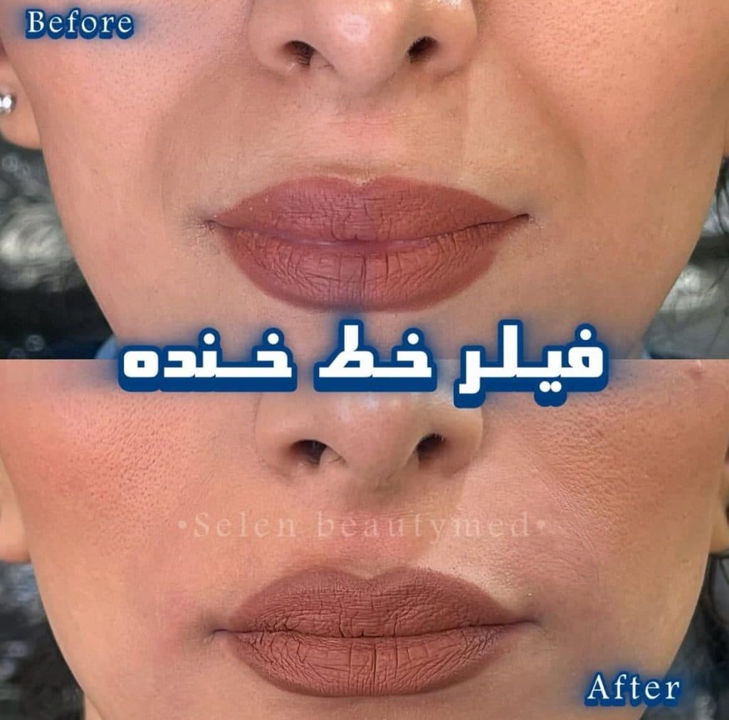 کلینیک تخصصی زیبایی پوست و مو سلن در بلوار سجاد مشهد