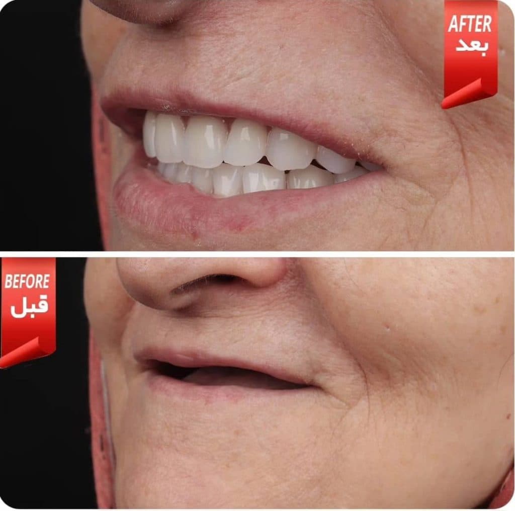دندانسازی زارعی در یزد