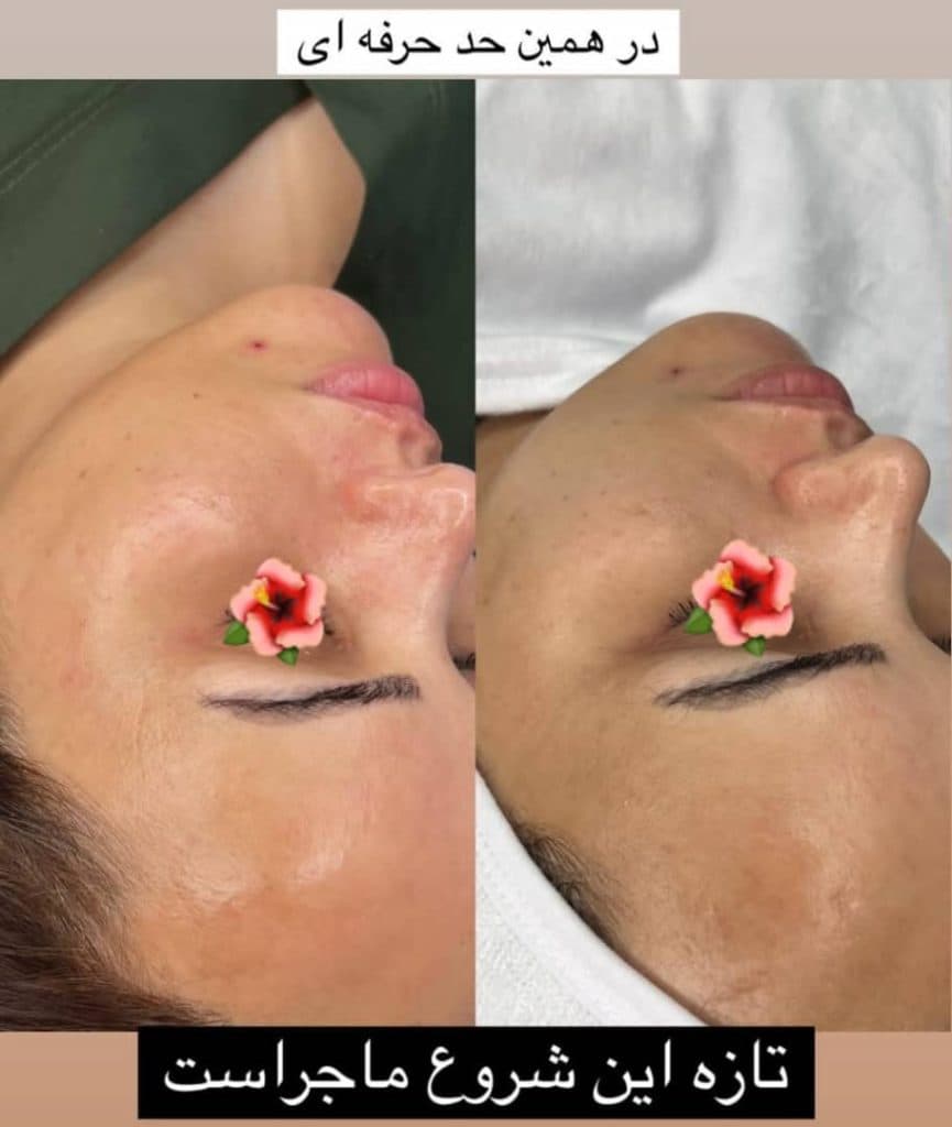 آموزش و خدمات تخصصی پاکسازی مراقبت از پوست و مو مریم ماندگار در بندرعباس