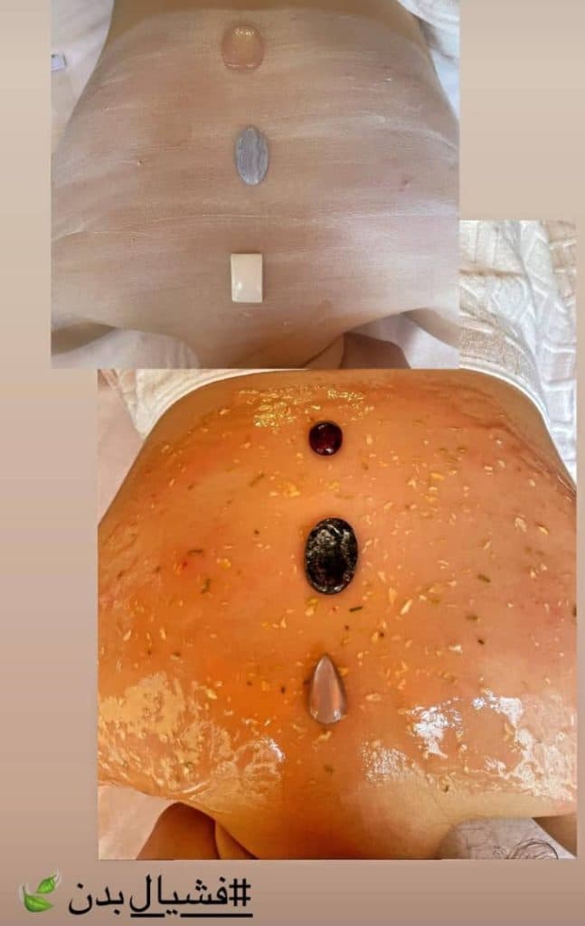 آموزش و خدمات تخصصی پاکسازی پوست و فشیال صورت هدیه تقویان در مشهد