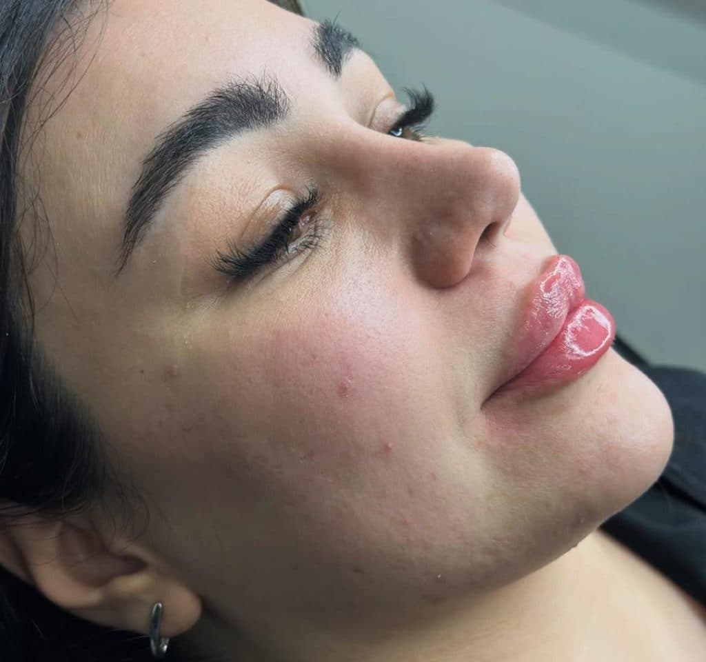 کلینیک زیبایی اپال در کرمانشاه