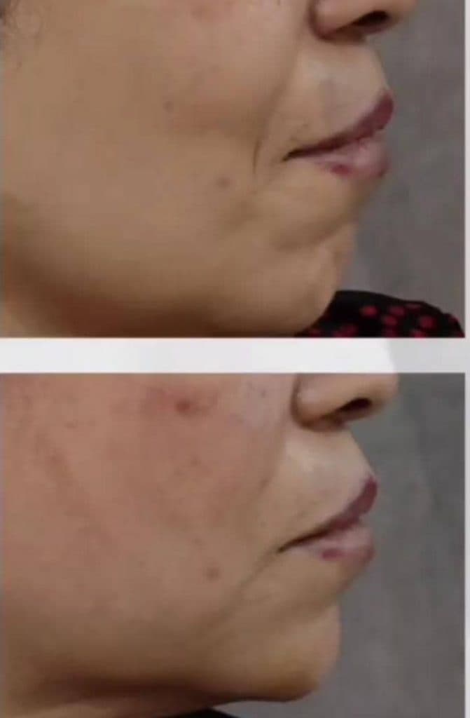 کلینیک زیبایی ویلانژ در ماهشهر