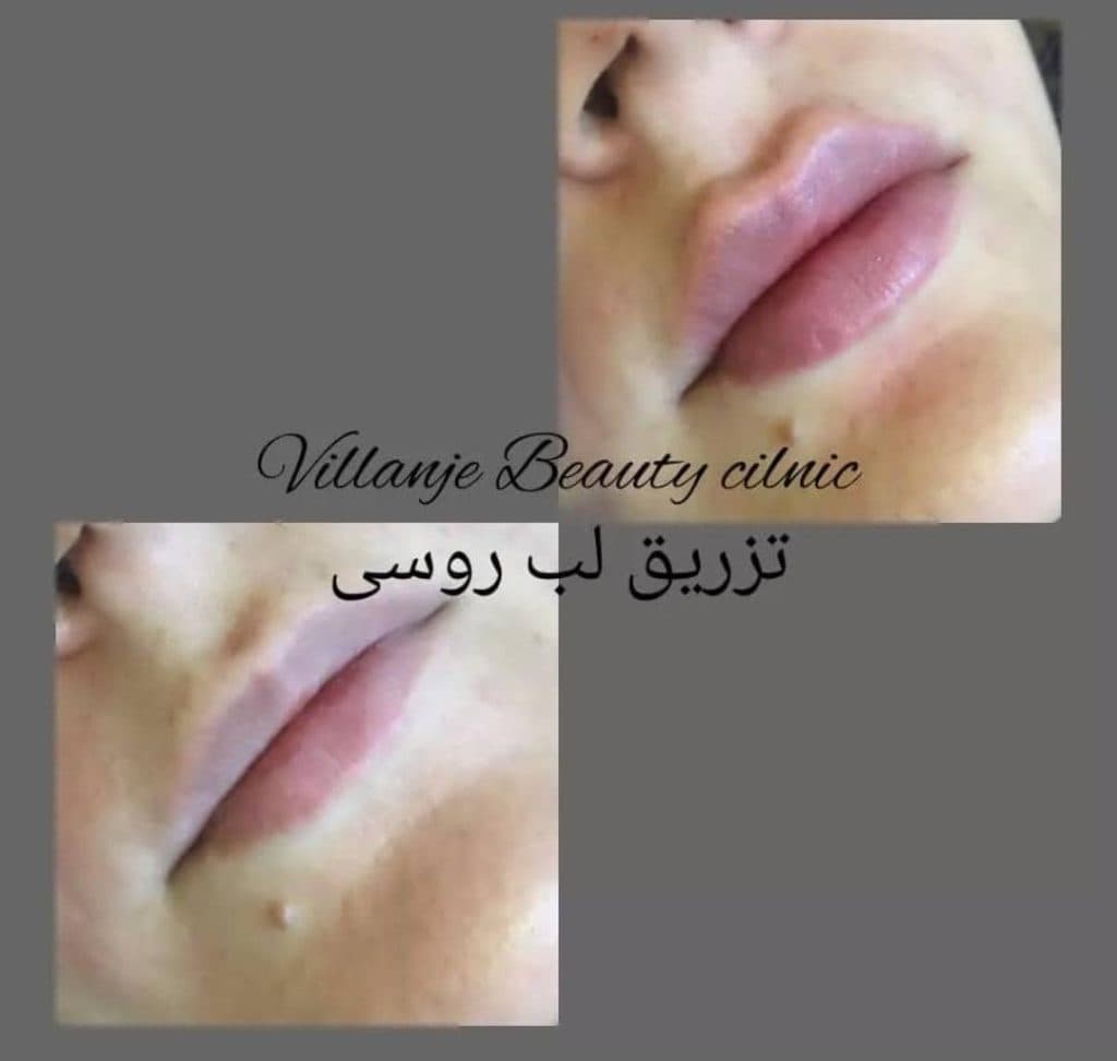 کلینیک زیبایی ویلانژ در ماهشهر