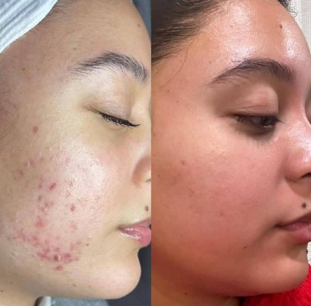 خدمات تخصصی فیشیال درمان لک و جوش زهرا مددی در کرمان