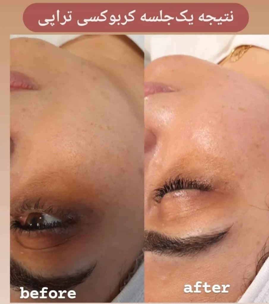 آموزشگاه تخصصی پاکسازی مراقبت از پوست و مو خاتون در بابل