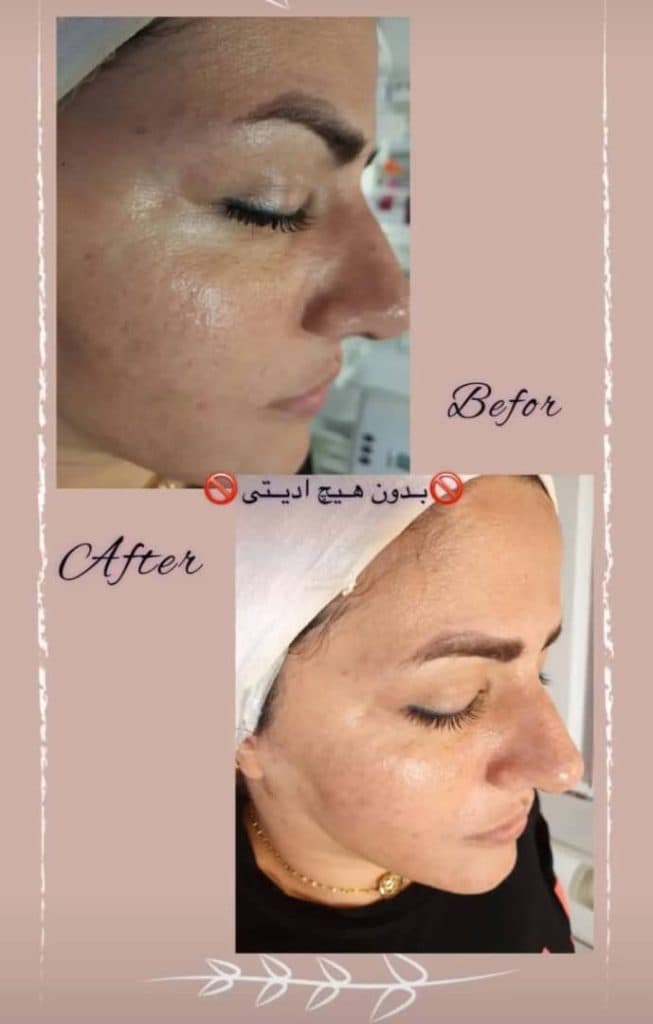 آموزشگاه تخصصی پاکسازی مراقبت از پوست و مو خاتون در بابل