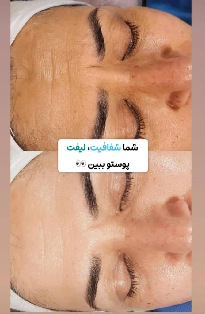 آموزشگاه تخصصی پاکسازی مراقبت از پوست و مو خاتون در بابل