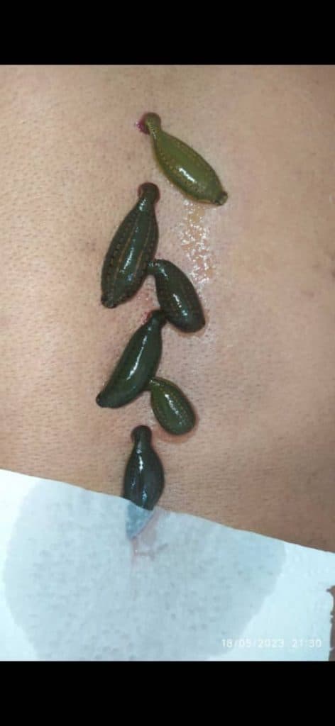 کلینیک طب سنتی و زالو درمانی سیب ملک پور در بندر امام خمینی