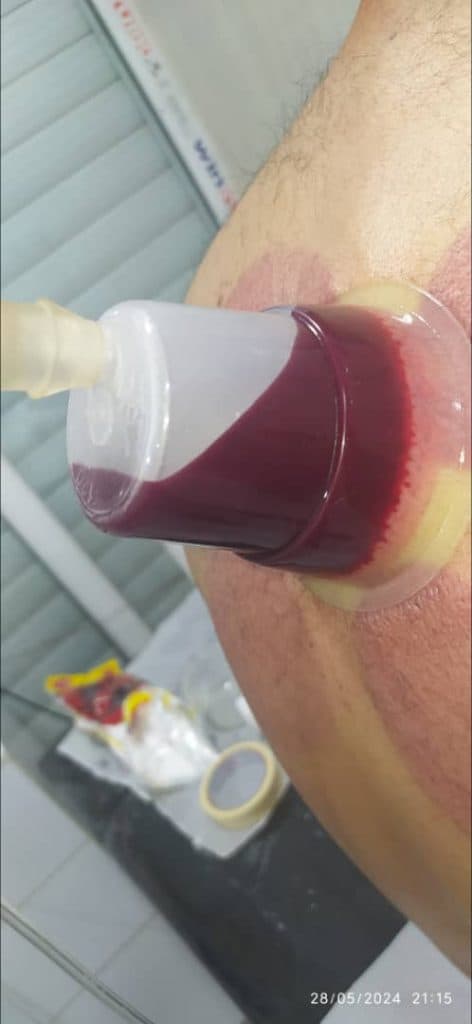 کلینیک طب سنتی و زالو درمانی سیب ملک پور در بندر امام خمینی