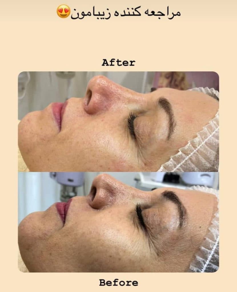 آکادمی آموزش خدمات پاکسازی و مراقبت از پوست و مو نگار سعیدزنوزی در هشتگرد